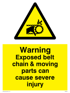 Exposed belt chain can cause severe injury